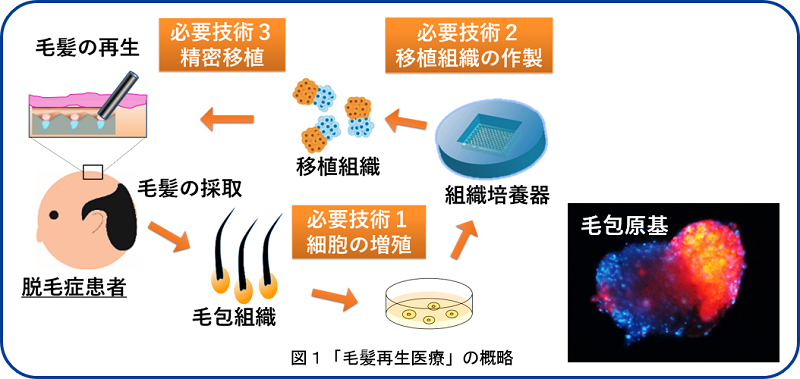 図1 毛髪再生医療の概略
必要技術1細胞の増殖、2移植組織の作製、3精密移植