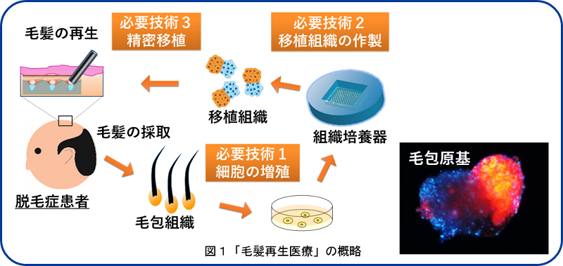 図1　毛髪再生医療の概略
必要技術１細胞の増殖、２移植組織の作製、３精密移植