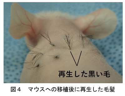 図４　マウスへの移植後に再生した毛髪