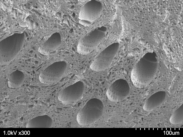 観察倍率300倍 太い孔が「道管」で根から水を吸い上げる管で、人間で言えば血管のようなものです。